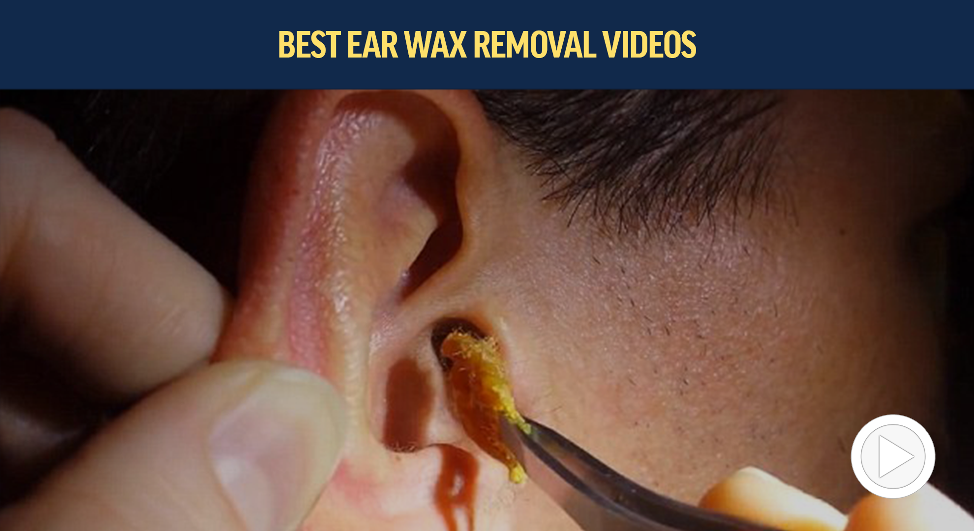 Ear wax removal - dos and don'ts you should know about